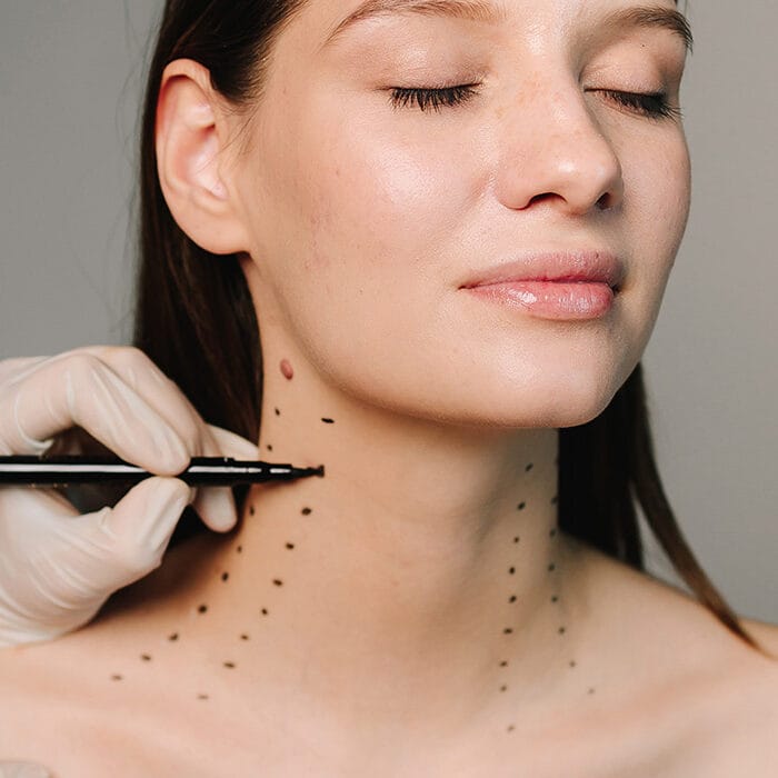 Botox Kaklinje
