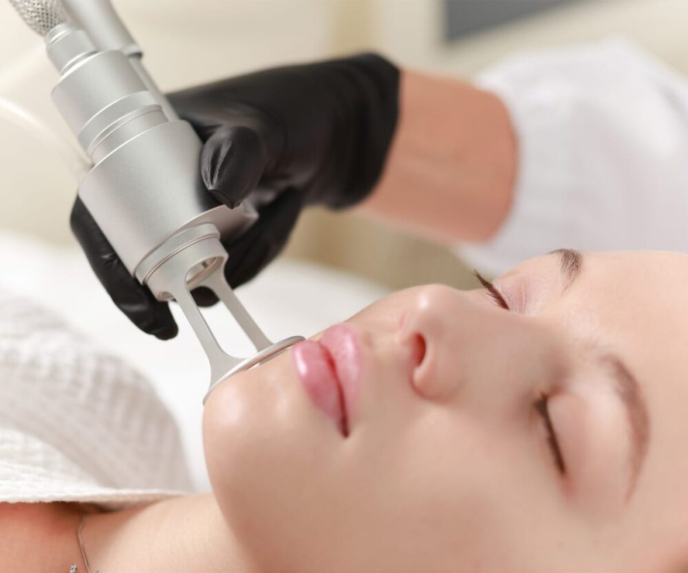 CO2 laser – hudforbattring cool peel