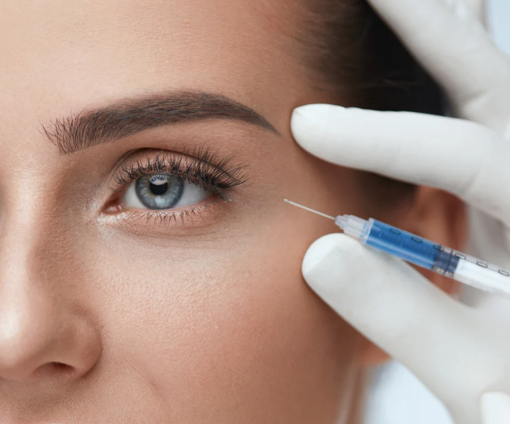Fillers in the temples